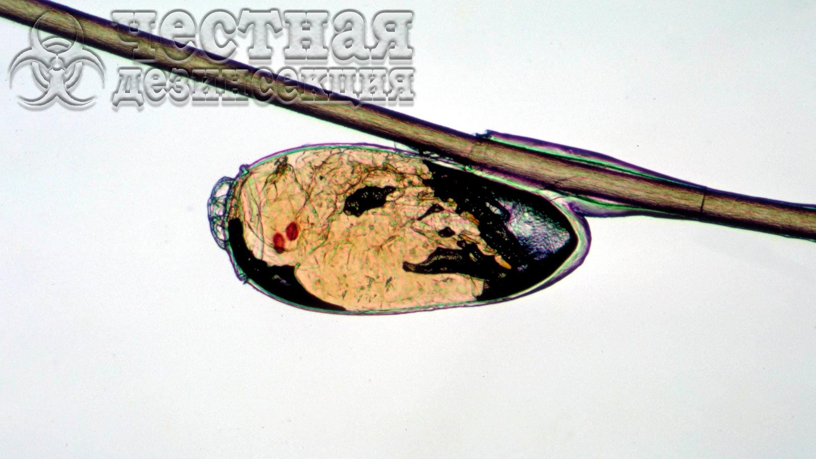 Личинка бельевой вши под микроскопом